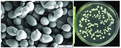 yeast combined